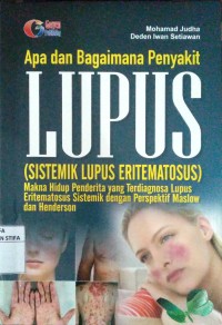 Apa dan Bagaimana Penyakit Lupus (Sistemik lupus eritematosus)