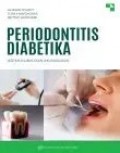 Periodontitis Diabetika (aspek Klinis dan imunologis)
